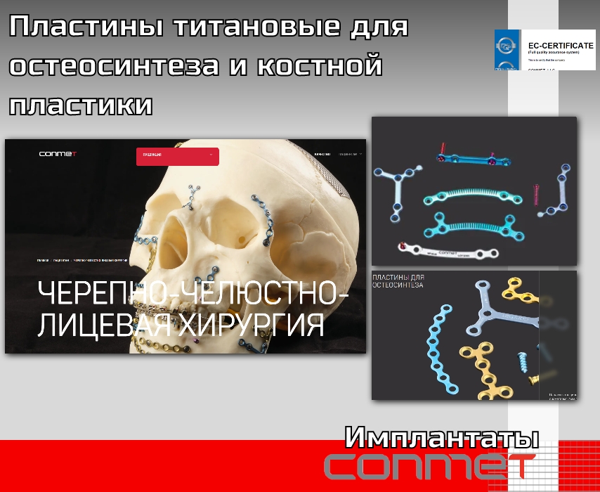 Пластины титановые для остеосинтеза и костной пластики - TitanRetail