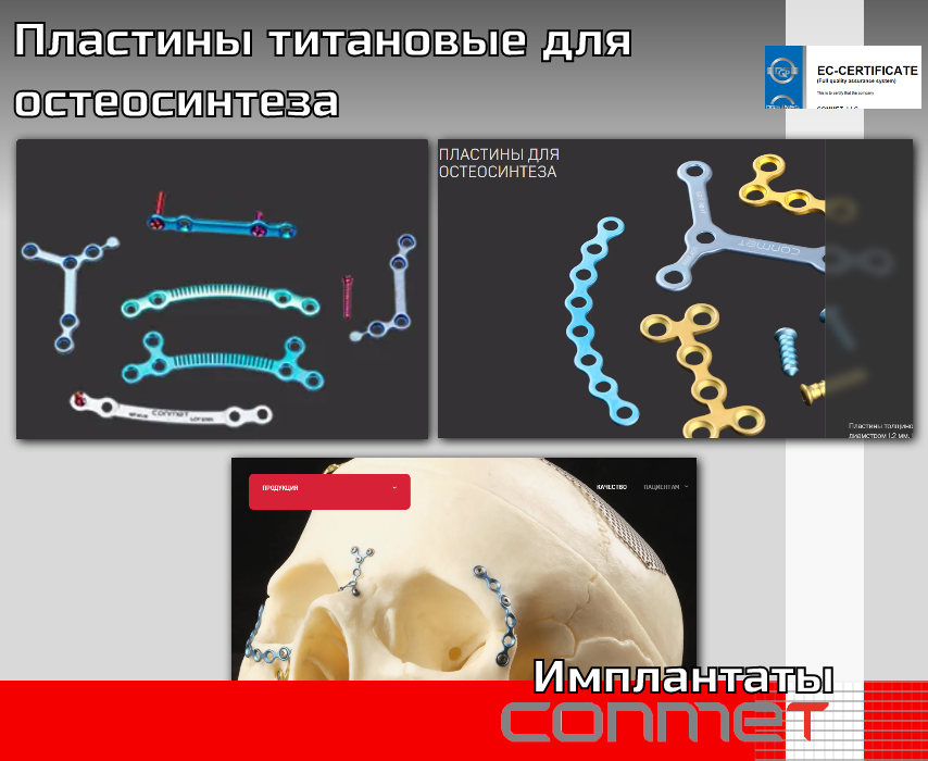 Микро и Мини-пластины для костной пластики 0.6 и 1.0 мм титановые - TitanRetail