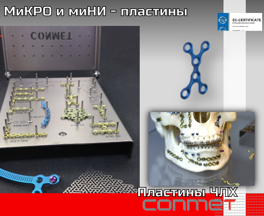 МиКРО и миНИ – пластины для остеосинтезаи ЧЛХ - TitanRetail