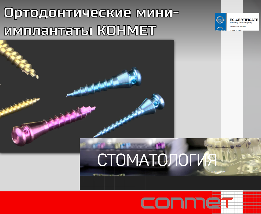 Ортодонтические титановые миниимплантаты КОНМЕТ краткая инструкция - TitanRetail