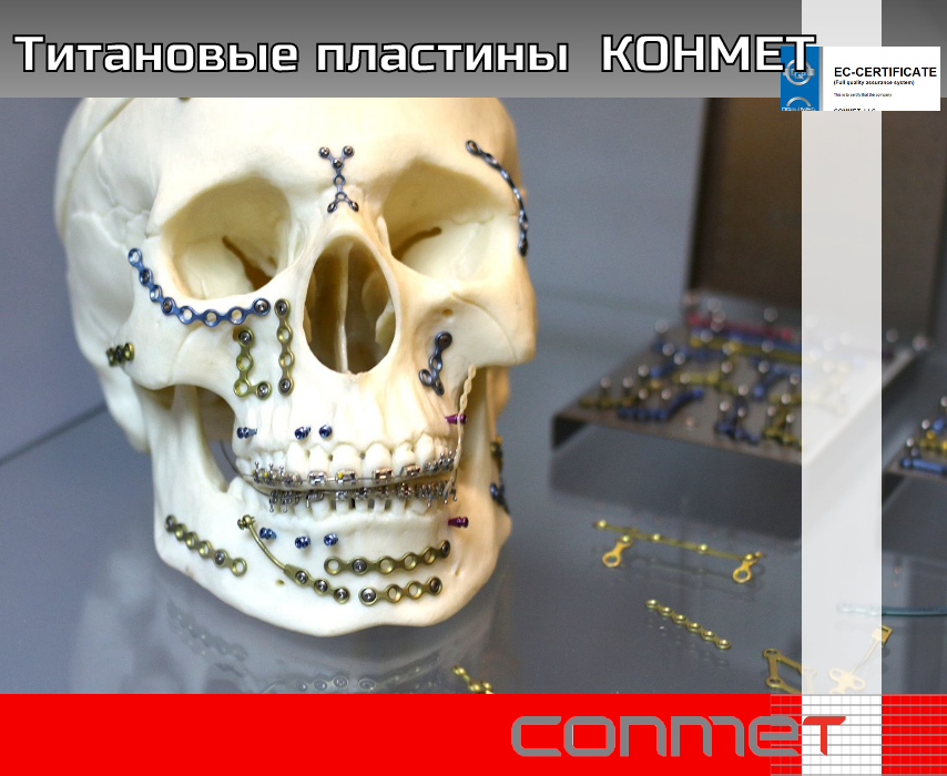 Титановые пластины КОНМЕТ - TitanRetail