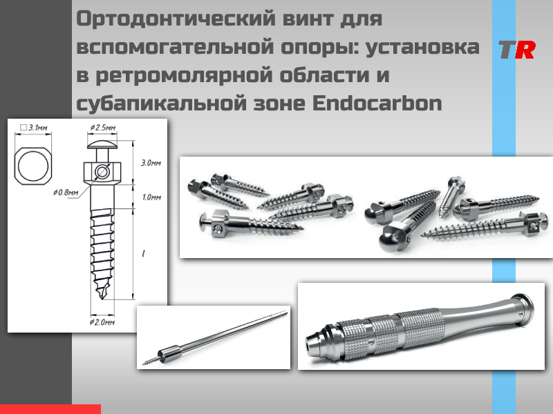 Ортодонтический винт для вспомогательной опоры: установка в ретромолярной области и субапикальной зоне В наличии! - TitanRetail